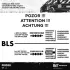 Розподільчий вал ET Engineteam HV0285 (фото 6)