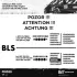 Розподільчий вал (к-т) ET Engineteam HV0338 (фото 10)