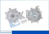 HYUNDAI Вискомуфта вентилятора радиатора Galloper,H-1/Starex/100 2.5D/TD 93- Kale 352760 (фото 1)